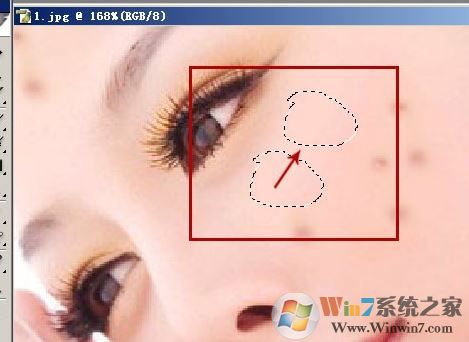 照片的臉上長痘痘怎么調(diào)?教你照片臉上長痘痘怎么去除